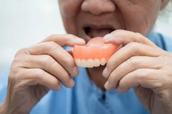 Complete Dentures